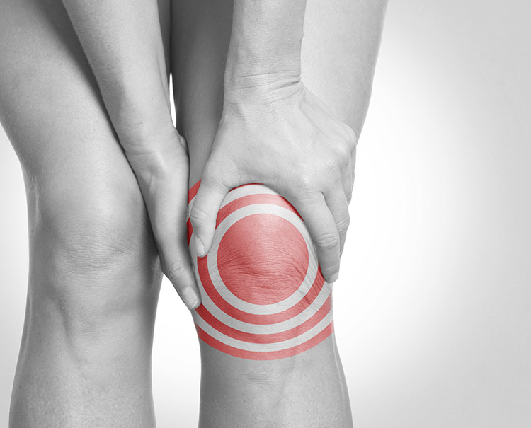 Was ist Arthrose? Schmerzhafter Knorpelschwund Was ist Arthrose? Schmerzhafter Knorpelschwund