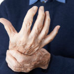 Rheumatische Arthritis: Symptome früh erkennen